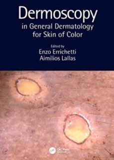 dermoscopy in general dermatology for skin of color-aimilios lallas-9780367418403