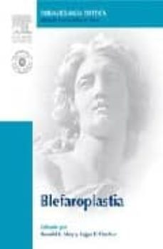 blefaroplastia (incluye dvd)-9788480862103