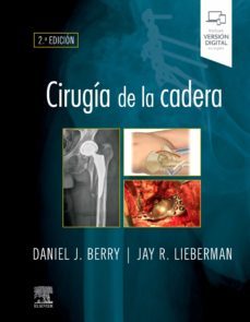 cirugía de la cadera (2ª ed.)-9788491139003