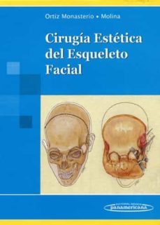 cirugia estetica del esqueleto facial-9789687988603