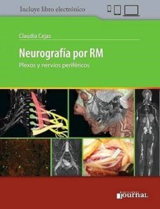neurografia por rm. plexos y nervios perifericos (libro + e-book)-c. cejas-9789874922403