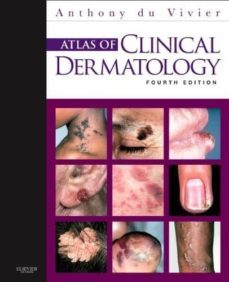 atlas of clinical dermatology (4th ed.)-anthony du vivier-9780702034213