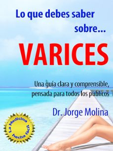 lo que debes saber sobre... varices (ebook)-jorge molina-9781311808813