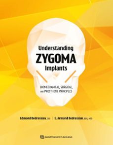 understanding zygoma implants (ebook)-edmond bedrossian-e. armand bedrossian-9781647242213