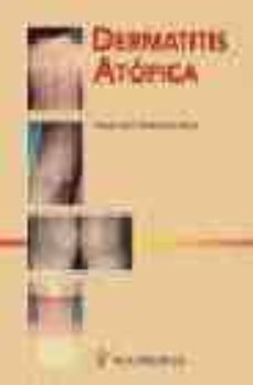 dermatitis atopica-jose luis eseverri asin-9788495670113