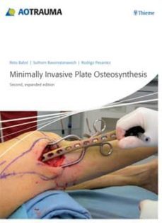 minimally invasive plate osteosynthesis (mipo) (2nd ed.)-r. babst-9783131433923