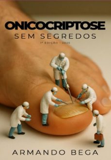 onicocriptose sem segredos (ebook)-armando bega-9786526658123