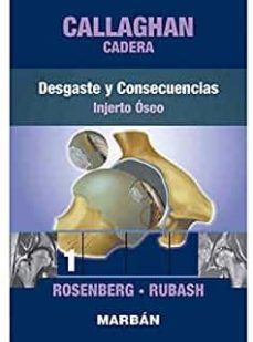 cadera 1: desgaste y consecuencias. injerto oseo-9788418068423