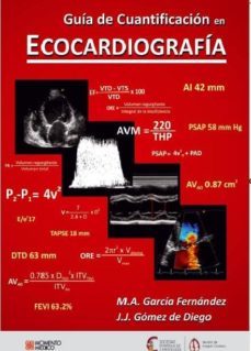 guia de cuantificacion en ecocardiografia-9788881602223