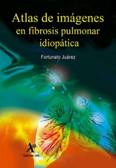 atlas de imagenes en fibrosis pulmonar idiopatica (ebook)-fortunato juárez hernández-9786077414933
