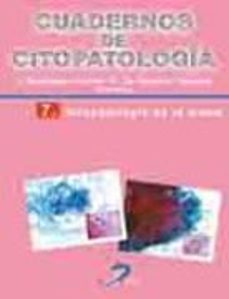 citopatologia de la mama-mercedes santamaria martinez-9788479789633