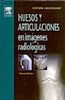 huesos y articulaciones en imagenes radiologicas-9788481748833