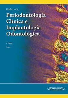 periodontologia clinica e implantologia odontologica tomo 1 (6ª ed)-jan lindhe-niklaus p. lang-9789500694933