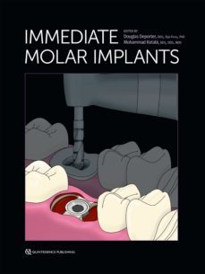 immediate molar implants (ebook)-douglas deporter-mohammad ketabi-9781647241643