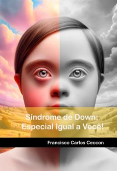 sindrome de down: especial igual a voce! (ebook)-carlos ceccon francisco-9786501223643