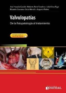 valvulopatias: de la fisiopatologia al tratamiento + acceso onlin e-9789871981243