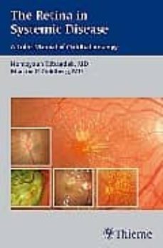 the retina in systemic disease: a color manual of ophtalmoscopy-homayoun tabandeh-9781604060553