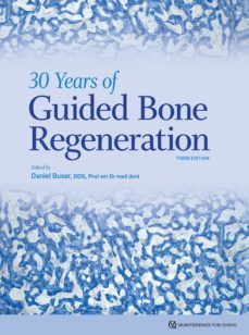 30 years of guided bone regeneration (ebook)-daniel buser-9781647241353