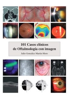 101 casos clinicos de oftalmologia con imagen-julio gonzalez martin moro-9788474297553
