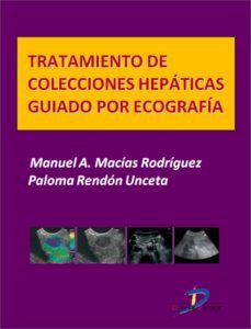 tratamiento de colecciones hepaticas guiado por ecografia (ebook)-manuel a. macias rodriguez-paloma rendon unceta-9788499697253