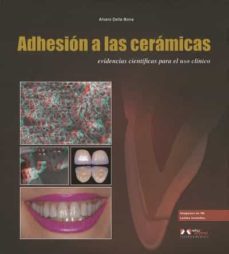 adhesion a las ceramicas-9788536700953