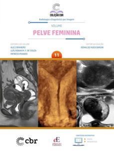 coleço cbr volume 11 pelve feminina (ebook)-ronaldo hueb baroni-alice brandão-luiz ronan m. f. de souza-9786561030663