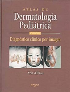 atlas de dermatologia pediatrica (2ª ed)-yon albisu-9788484737063