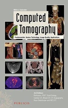 computed tomography: fundamentals, system technology, image quality, applications (3rd ed.)-willi a. kalender-9783895783173