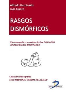 rasgos dismórficos (ebook)-alfredo garcia alix-jose quero-9788499691473