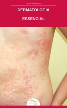 dermatologia essencial (ebook)-knowledge flow-9789557604473