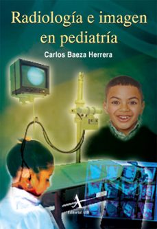 radiologia e imagen en pediatria (ebook)-carlos baeza herrera-9786077410683