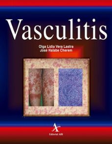 vasculitis (ebook)-olga lidia vera lastra-josé halabe cherem-9786077415183
