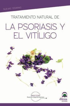 tratamiento natural de la psoriasis y el vitiligo-9788498276183