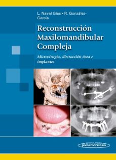 reconstruccion maxilomandibular compleja. microcirugia, distraccion osea e implantes- naval gias-9788498356083