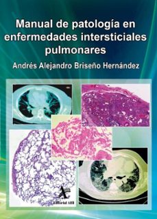 manual de patologia en enfermedades intersticiales pulmonares (ebook)-andrés alejandro briseño hernández-9786077415893