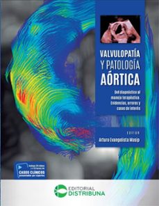 valvulopatia y patologia aortica (ebook)-arturo evangelista-masip-9786287673793