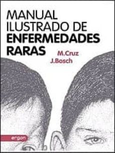 manual ilustrado de enfermedades raras-manuel cruz hernandez-juan bosch hugas-9788415351993