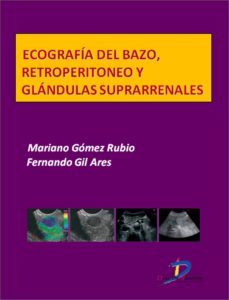 ecografia del bazo, retroperitoneo y glandulas suprarrenales (ebook)-mariano gomez rubio-fernando gil ares-9788499697093