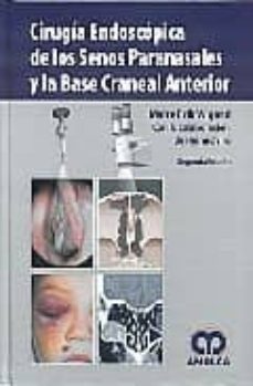 cirugia endoscopica de los senos paranasales y la base craneal an terior (2ª ed.)-malte erik wigand-9789588473093