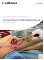 minimally invasive plate osteosynthesis (mipo) (2nd ed.)-r. babst-9783131433923 minimally invasive plate osteosynthesis (mipo) (2nd ed.)-r. babst-9783131433923