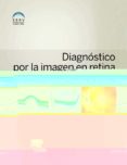diagnostico por la imagen en retina-9788490227213 diagnostico por la imagen en retina-9788490227213