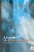 lesiones de la mano y la muñeca-carlos irisarri castro-9788480198233 lesiones de la mano y la muñeca-carlos irisarri castro-9788480198233