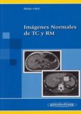 imagenes normales de tc y rm.-emil reif-torsten b. möller-9788479035143 imagenes normales de tc y rm.-emil reif-torsten b. möller-9788479035143