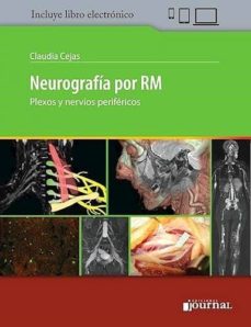 eBookStore: NEUROGRAFIA POR RM. PLEXOS Y NERVIOS PERIFERICOS (LIBRO + E-BOOK) 9789874922403 PDF MOBI ePub in Spanish de C. CEJAS