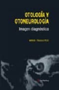 Buenos libros descargar ipad OTOLOGIA Y OTONEUROLOGIA: IMAGEN DIAGNOSTICA de MANUEL TRUJILLO PECO