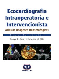 Libros gratis para descargar a ipod. ECOCARDIOGRAFIA INTRAOPERATORIA E INTERVENCIONISTA: ATLAS DE IMAGENES TRANSESOFAGICAS (2ª ED.) 9789585426733 (Spanish Edition) PDF de C. & OTTO