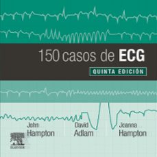 Amazon stealth descargar ebook gratis 150 CASOS DE ECG  5ª ED, in Spanish