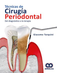 Descargar pdf de libros gratis. TÉCNICAS DE CIRUGIA PERIODONTAL. DEL DIAGNOSTICO A LA TERAPIA 9789804301063 (Spanish Edition) RTF PDF