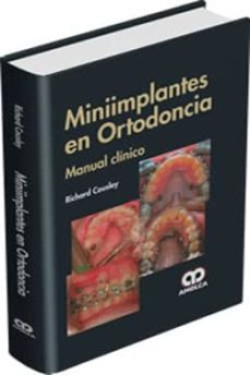 Ebook fr descargar MINIIMPLANTES EN ORTODONCIA. MANUAL CLINICO en español 9789588816593 PDB PDF